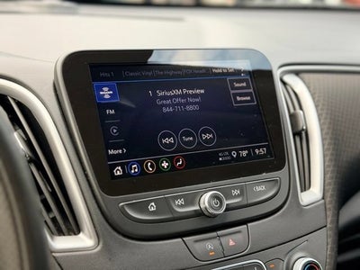 2025 Chevrolet Malibu 1LT